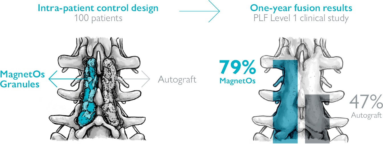 Grow bone with magnetos kuros biosciences