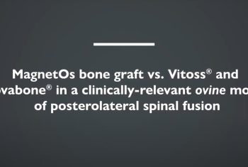 Van Dijk, et al. Clin Spine Surg. 2020;33(6):E276-E287.